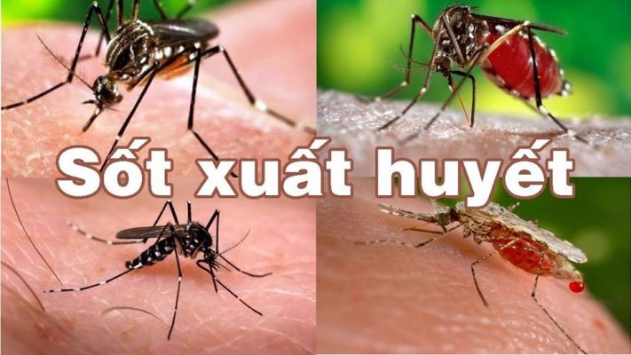 Dịch sốt xuất huyết và những lưu ý (Phần 2)